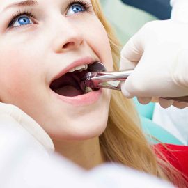 tooth-extraction-and-socket-preservation-2 tooth-extraction-and-socket-preservation-2